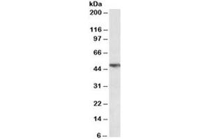 Western blot testing of human lung lysate with TNFR1 antibody at 0. (TNFRSF1A antibody)