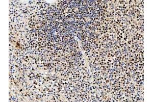 IHC analysis of SDE2 using anti-SDE2 antibody (ABIN7599603). (C1orf55 antibody  (AA 10-447))