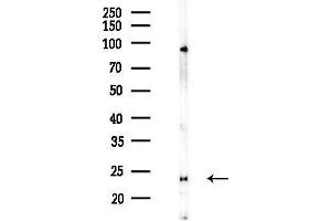 Western blot analysis of lysates from Mouse brain, using UMP/CMP kinase Antibody at 1/1000 dilution.