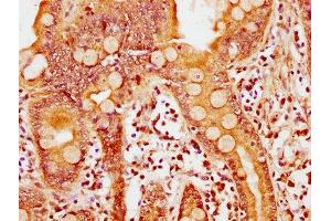IHC image of ABIN7149505 diluted at 1:600 and staining in paraffin-embedded human small intestine tissue performed on a Leica BondTM system. (APPL2 antibody  (AA 399-512))