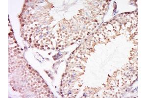 Formalin-fixed and paraffin embedded mouse testis tissue labeled with REV3L Polyclonal Antibody, Unconjugated  at 1:200 followed by conjugation to the secondary antibody and DAB staining (REV3L antibody  (AA 2701-2800))