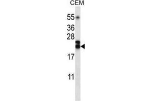 TNFSF4 Antibody (Center) western blot analysis in CEM cell line lysates (35 µg/lane).