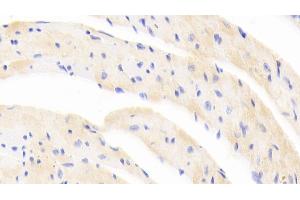 Detection of EPOR in Mouse Cardiac Muscle Tissue using Polyclonal Antibody to Erythropoietin Receptor (EPOR) (EPOR antibody  (AA 45-244))