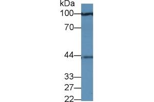 Detection of PRAME in Human 293T cell lysate using Polyclonal Antibody to Preferentially Expressed Antigen In Melanoma (PRAME) (PRAME antibody  (AA 416-502))