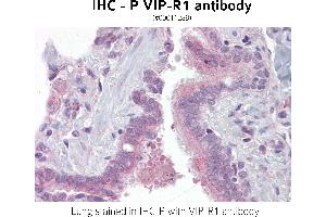 Image no. 1 for anti-Vasoactive Intestinal Peptide Receptor 1 (VIPR1) antibody (ABIN375279) (VIPR1 antibody)