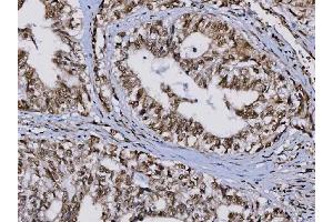 IHC analysis of TIP49A/RUVBL1 using anti-TIP49A/RUVBL1 antibody (ABIN7599928).
