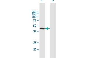 Western Blot analysis of ZCCHC11 expression in transfected 293T cell line by ZCCHC11 MaxPab polyclonal antibody. (ZCCHC11 antibody  (AA 1-309))