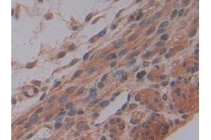 Detection of MMP7 in Mouse Uterus Tissue using Polyclonal Antibody to Matrix Metalloproteinase 7 (MMP7)