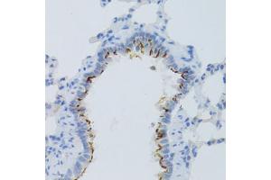 Immunohistochemistry of paraffin-embedded rat lung using PTGER2 Antibody (ABIN1874408) at dilution of 1:100 (40x lens).