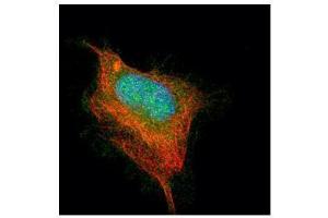 ICC/IF Image Confocal immunofluorescence analysis (Olympus FV10i) of paraformaldehyde-fixed HeLa, using AChE, antibody (Green) at 1:500 dilution. (Acetylcholinesterase antibody  (C-Term))