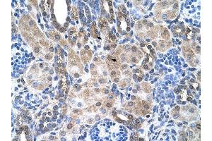 SLC6A18 antibody was used for immunohistochemistry at a concentration of 4-8 ug/ml to stain Epithelial cells of renal tubule (arrows) in Human Kidney. (SLC6A18 antibody  (Middle Region))