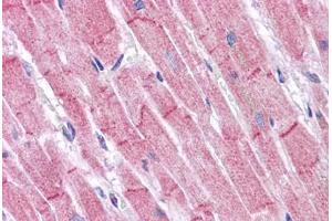 Human Heart: Formalin-Fixed, Paraffin-Embedded (FFPE) (RHBDD3 antibody  (Internal Region))