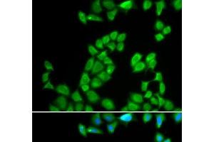 Immunofluorescence analysis of MCF-7 cells using RNASE13 Polyclonal Antibody (RNASE13 antibody)