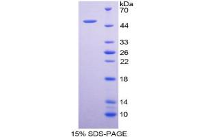 Image no. 1 for Surfactant Protein C (SFTPC) (AA 24-197) protein (His tag,GST tag) (ABIN4988782)