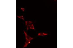 ABIN6275083 staining HeLa cells by IF/ICC. (DNAL1 antibody  (Internal Region))