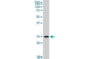 RAB33B monoclonal antibody (M01), clone 6F4. (RAB33B antibody  (AA 117-206))