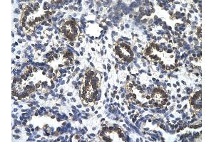 Rabbit Anti-TAF5L Antibody       Paraffin Embedded Tissue:  Human alveolar cell   Cellular Data:  Epithelial cells of renal tubule  Antibody Concentration:   4. (TAF5L antibody  (N-Term))