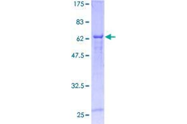 Cyclin M3 Protein (CNNM3) (AA 1-355) (GST tag)