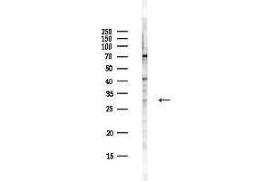 Western blot analysis of lysates from Hela cells(UV,30 min treatment), using PARM1 Antibody at 1/1000 dilution.