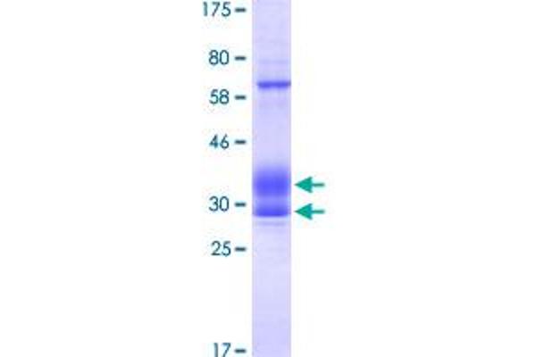 DcR2 Protein (AA 238-386) (His-DYKDDDDK-Strep II Tag)
