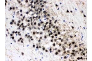 ZWINT was detected in paraffin-embedded sections of rat brain tissues using rabbit anti- ZWINT Antigen Affinity purified polyclonal antibody (Catalog # ) at 1 µg/mL. (ZWINT antibody  (AA 29-249))