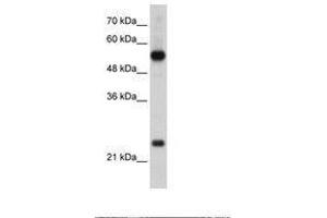 Image no. 1 for anti-Ribosomal Protein L13 (RPL13) (AA 136-185) antibody (ABIN203301)