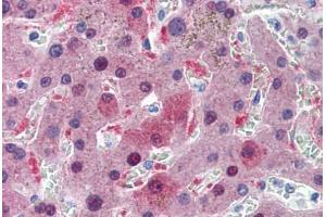 Human Liver: Formalin-Fixed, Paraffin-Embedded (FFPE) (GSTA1 antibody  (AA 1-222))