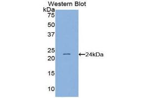 Western Blotting (WB) image for anti-PC4 and SFRS1 Interacting Protein 1 (PSIP1) (AA 311-469) antibody (ABIN1859640)