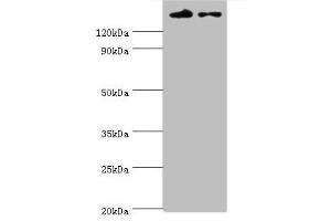 Western blot All lanes: SETDB1 antibody at 5 μg/mL Lane 1: Rat adrenal gland tissue Lane 2: 293T whole cell lysate Secondary Goat polyclonal to rabbit IgG at 1/10000 dilution Predicted band size: 144, 45 kDa Observed band size: 144 kDa