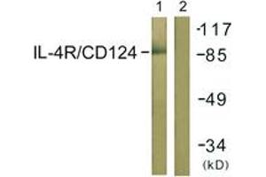 Western blot analysis of extracts from 293 cells, using IL-4R/CD124 (Ab-497) Antibody. (IL4 Receptor antibody  (AA 463-512))