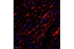 Immunofluorescence analysis of paraffin embedded mouse heart using PLXNC1 (ABIN7075109) at dilution of 1: 650