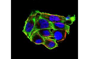 Immunofluorescence analysis of Hela cells using VIL1 mouse mAb (green). (Villin 1 antibody  (AA 1-209))