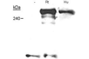 Western blot analysis of NF1 in Schwann cells from embryonic knockout mice, adult human nerves and neonatal rat nerves with NF1 monoclonal antibody, clone McNFn27a . (Neurofibromin 1 antibody  (AA 27-41))