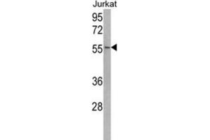 Western Blotting (WB) image for anti-Ubiquitin Specific Peptidase 22 (USP22) antibody (ABIN3001480)