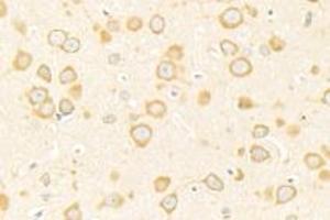 Immunohistochemistry (Paraffin-embedded Sections) (IHC (p)) image for anti-ADAM Metallopeptidase with Thrombospondin Type 1 Motif, 4 (ADAMTS4) antibody (ABIN7072947)