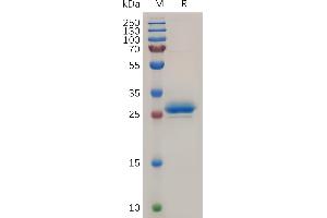 SDS-PAGE (SDS) image for Mesothelin (MSLN) (AA 37-286) protein (His tag) (ABIN7490827)