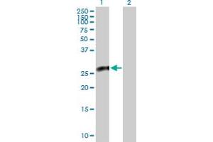 Western Blot analysis of CACYBP expression in transfected 293T cell line by CACYBP MaxPab polyclonal antibody.