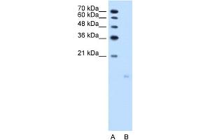 WB Suggested Anti-PPFIBP1 Antibody Titration:  2.