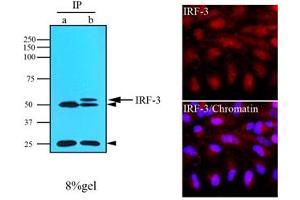 Immunofluorescence (IF) image for anti-Interferon Regulatory Factor 3 (IRF3) (AA 108-166) antibody (ABIN306424)
