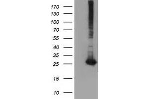 Western Blotting (WB) image for anti-Glutathione S-Transferase theta 2 (GSTT2) antibody (ABIN1498555) (GSTT2 antibody)