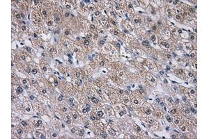 Immunohistochemical staining of paraffin-embedded liver tissue using anti-AKR1A1mouse monoclonal antibody. (AKR1A1 antibody)