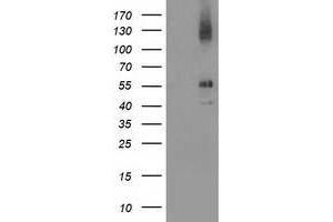 HEK293T cells were transfected with the pCMV6-ENTRY control (Left lane) or pCMV6-ENTRY LMCD1 (Right lane) cDNA for 48 hrs and lysed. (LMCD1 antibody)