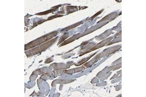 Immunohistochemical staining of human skeletal muscle with C1orf130 polyclonal antibody  shows strong cytoplasmic positivity in myocytes at 1:20-1:50 dilution. (NCMAP antibody)