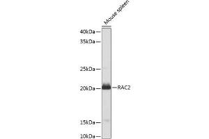 Western blot analysis of extracts of Mouse spleen using RAC2 Polyclonal Antibody at dilution of 1:1000. (RAC2 antibody)
