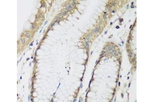 METTL7A antibody