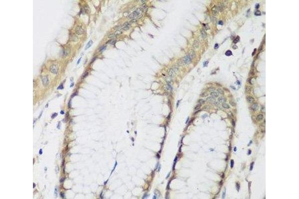 METTL7A antibody