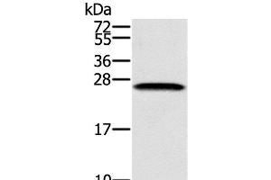 Western Blot analysis of K562 cell using SSX1 Polyclonal Antibody at dilution of 1:400 (SSX1 antibody)