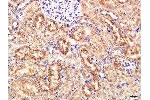 Paraformaldehyde-fixed, paraffin embedded Mouse Kidney tissue, Antigen retrieval by boiling in sodium citrate buffer(pH6) for 15min, Block endogenous peroxidase by 3% hydrogen peroxide for 20 minutes, Blocking buffer (normal goat serum) at 37°C for 30min, Antibody incubation with KRAS Polyclonal Antibody, Unconjugated  at 1:400 overnight at 4°C, followed by a conjugated secondary and DAB staining (K-RAS antibody  (AA 25-130))