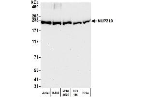 anti-Nucleoporin 210kDa (NUP210) (AA 1837-1887) antibody