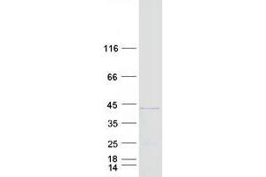 Coiled-Coil Domain Containing 68 (CCDC68) (Transcript Variant 1) protein (Myc-DYKDDDDK Tag)